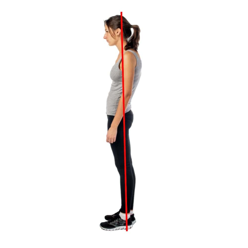 swayback posture diagram