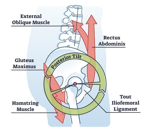 posterior pelvic tilt diagram