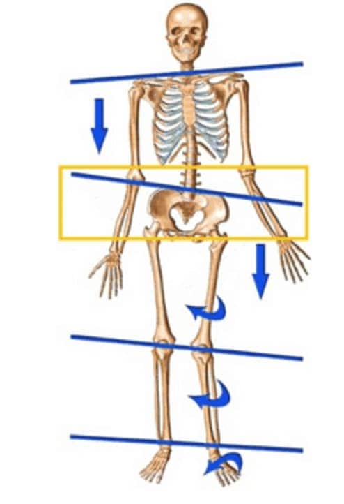lateral pelvic tilt diagram